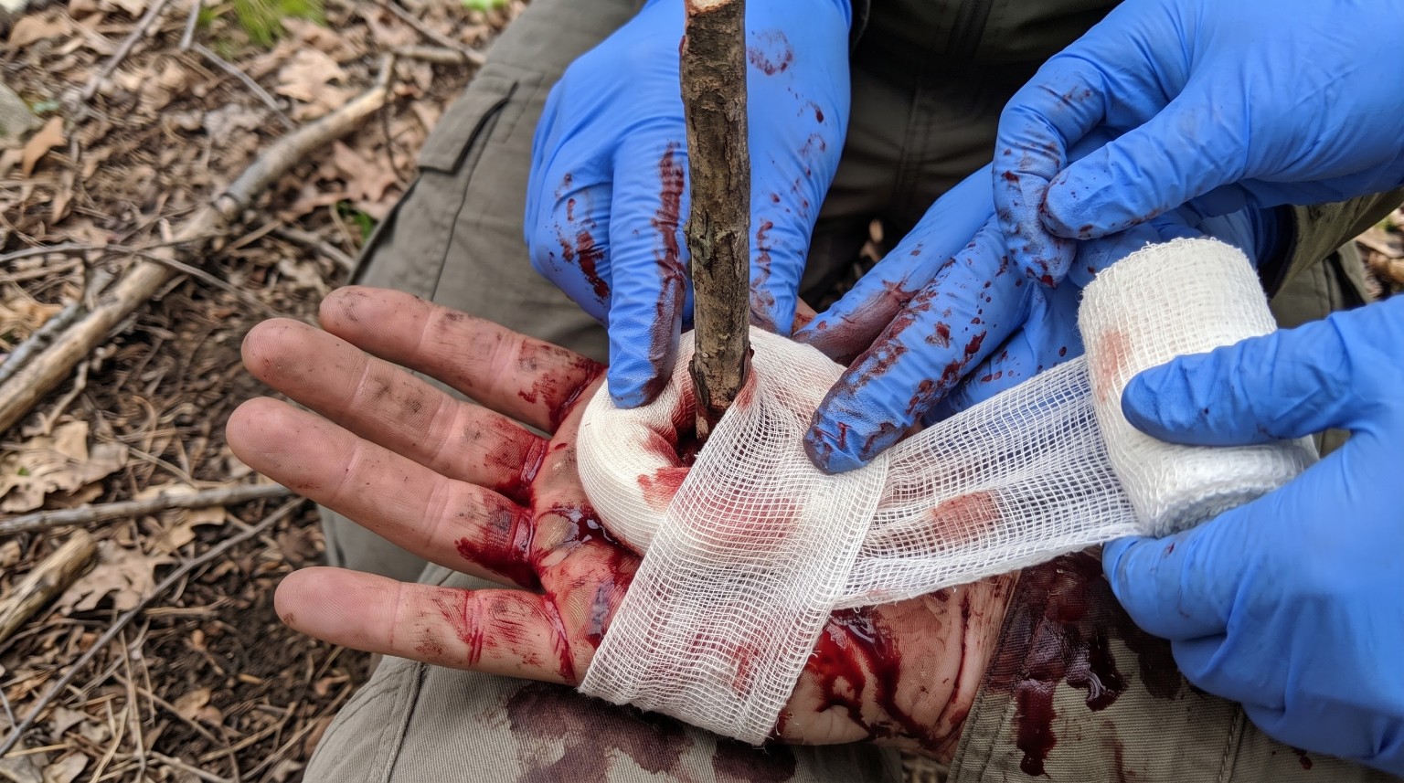 Gloved hands secure gauze around a doughnut pad surrounding a simulated branch impalement in a participant’s palm.